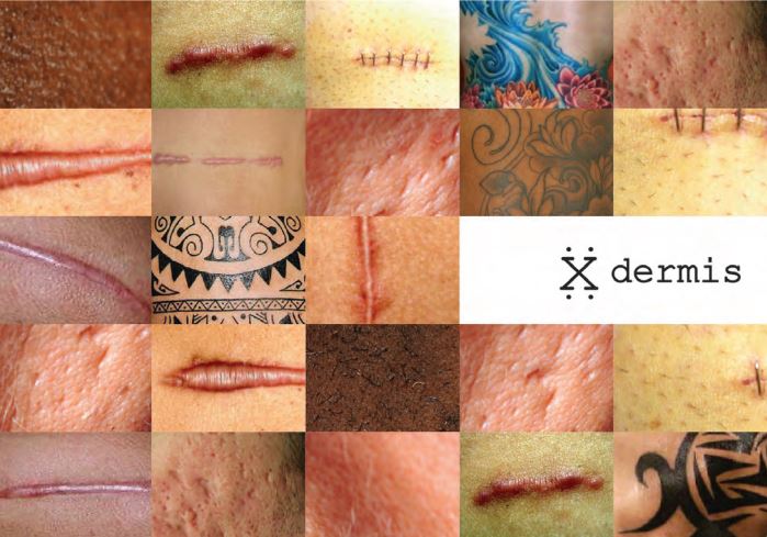 Dermis - Pantalla de proyección viva